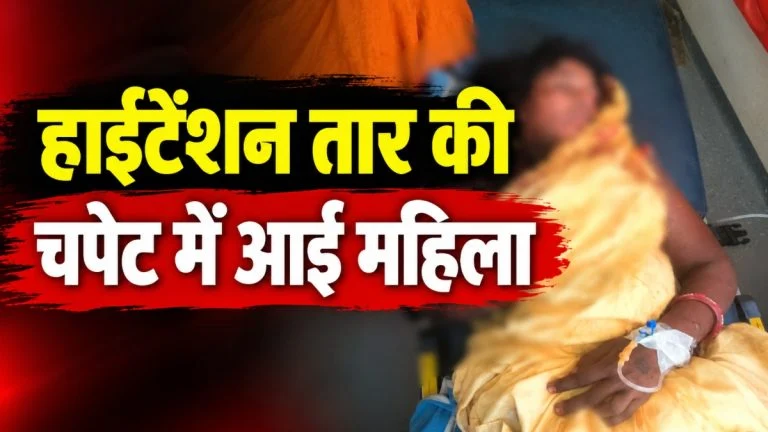 टूटे हाईटेंशन तार की चपेट में आई महिला, करंट से बुरी तरह झुलसने के बाद कटकर अलग हुआ हाथ, अम्बिकापुर मेडिकल कॉलेज रेफर